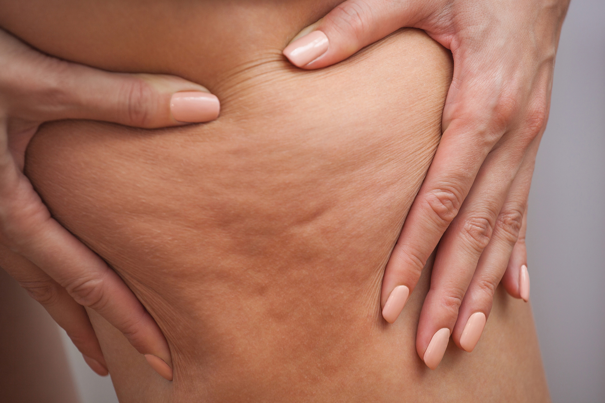 A Simple Guide on How to Get Rid of Cellulite