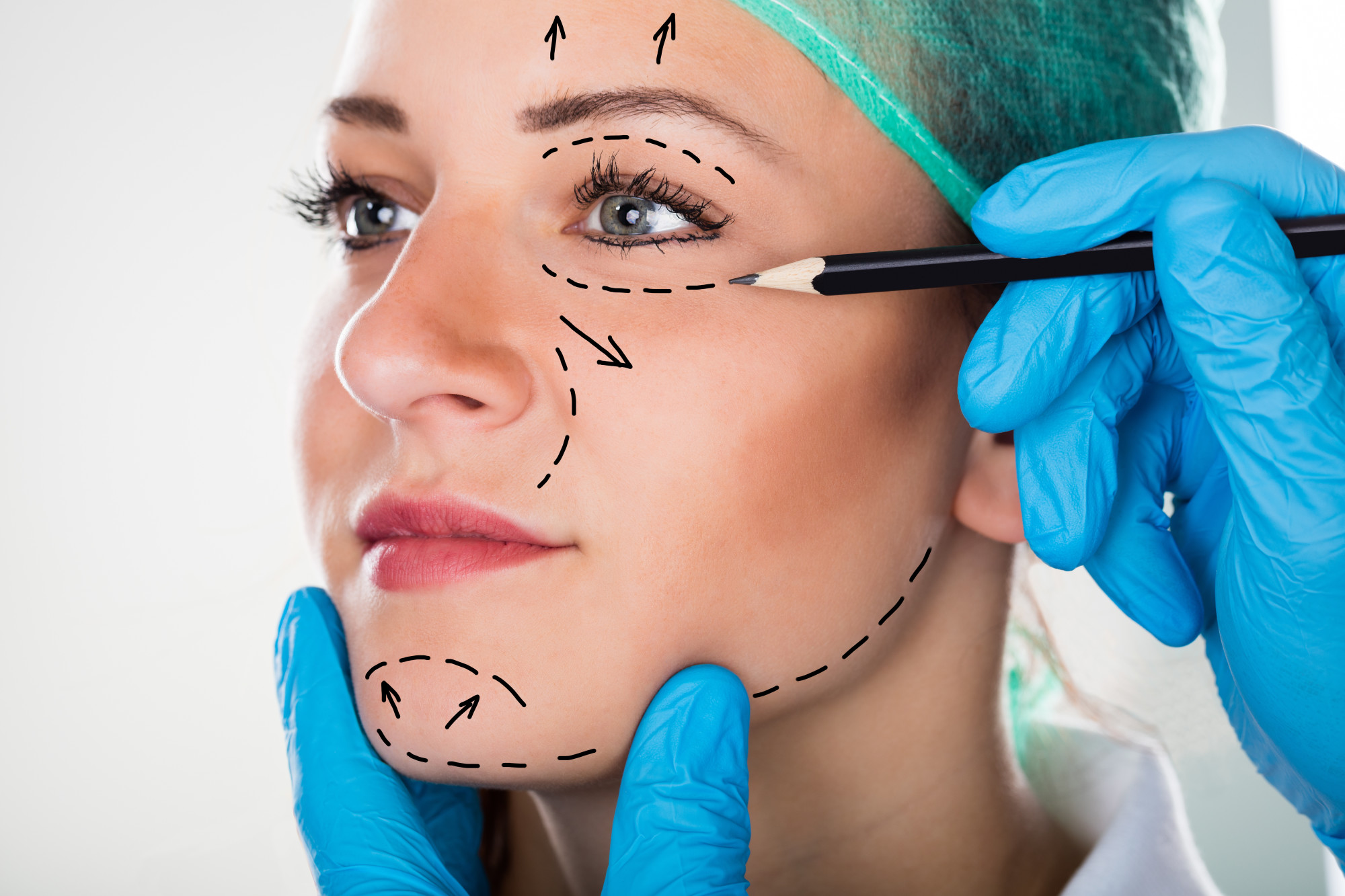 What to Expect From Rhinoplasty Surgery Recovery