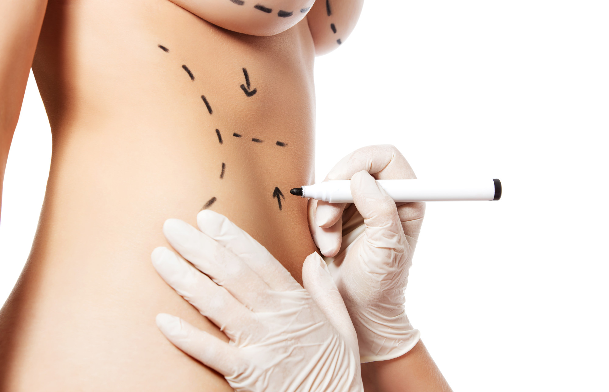 A Rejuvenated You: Is Cosmetic Surgery Right for You?