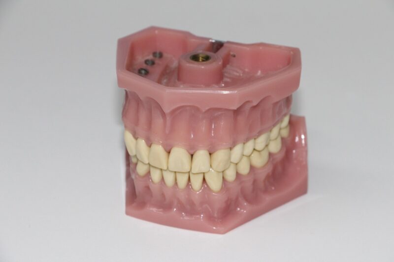 5 Signs You Need Denture Repairs Right Now