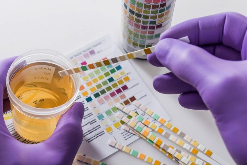 Best Synthetic Urine Kits: Top Fake Pee Brands to Pass a Drug Test