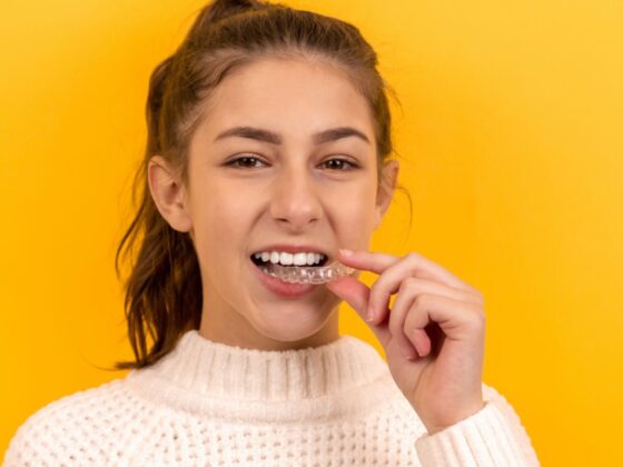 great benefits of Impress clear aligners
