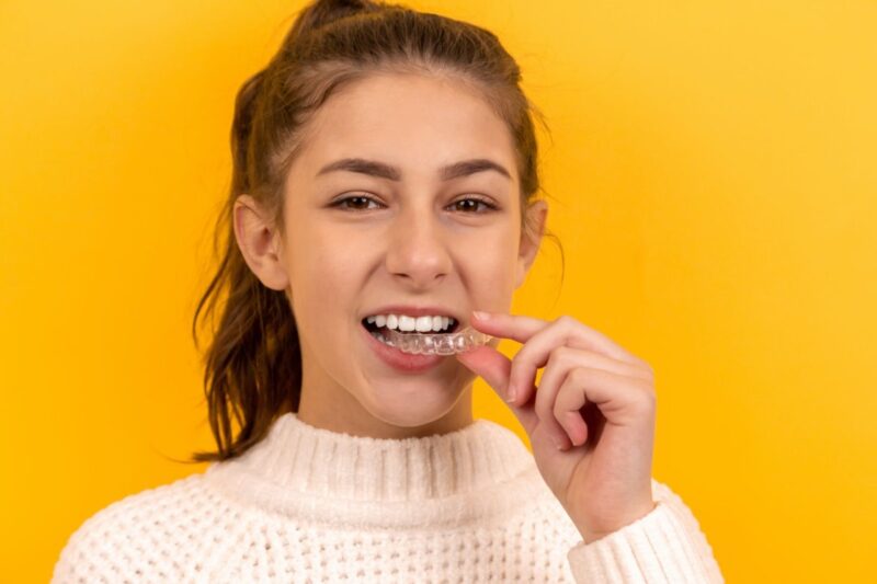 All you need to know about the great benefits of Impress clear aligners