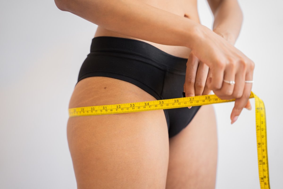 Weight Loss recommendations: Do you need a bariatric procedure?