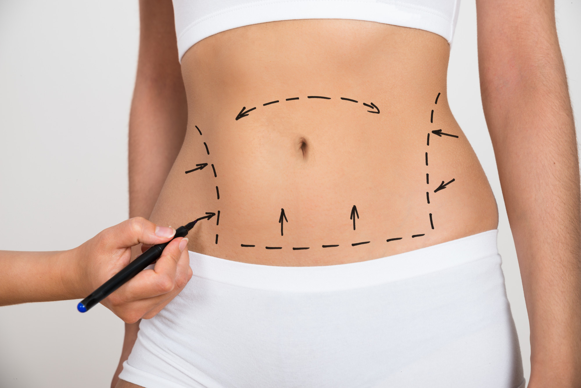 How to Choose a Plastic Surgeon: The Basics Explained