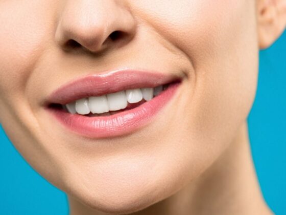 5 Easy Ways to Whiten Your Teeth Naturally at Home