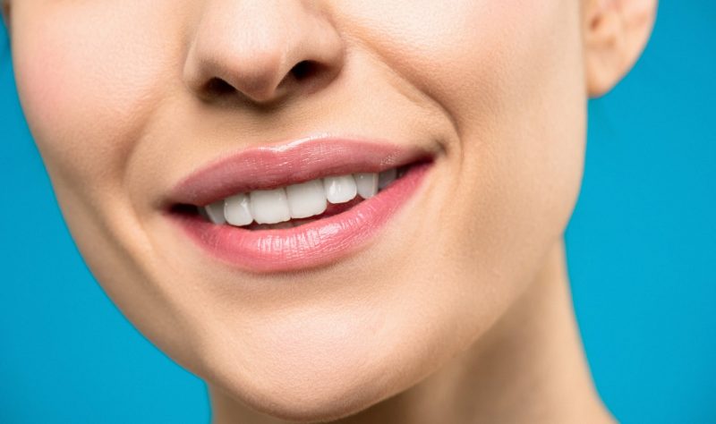 5 Easy Ways to Whiten Your Teeth Naturally at Home