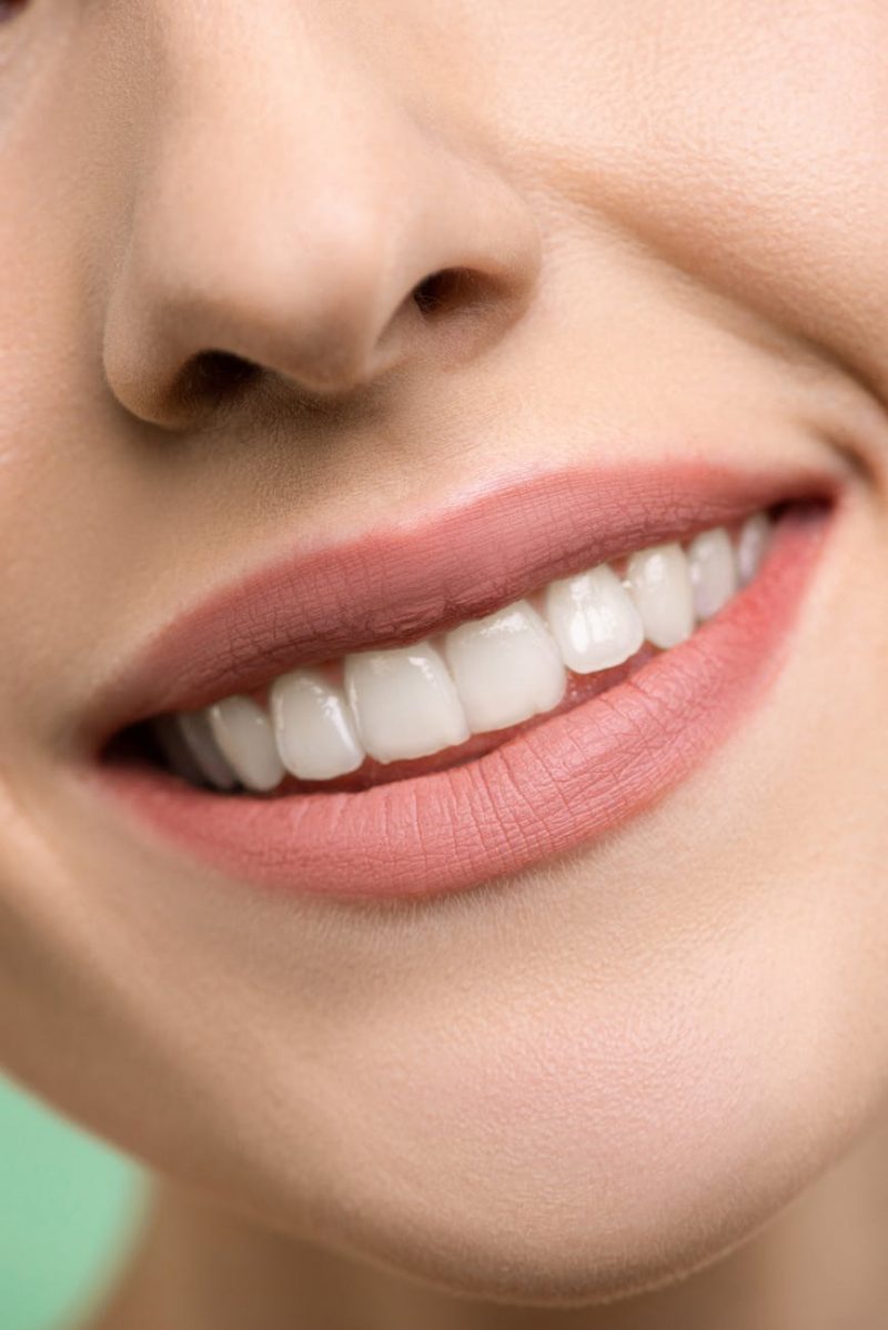 Types and Benefits of Dental Implants